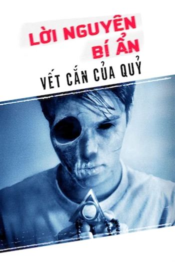 Hiện Tượng Siêu Nhiên Vết Cắn Của Quỷ